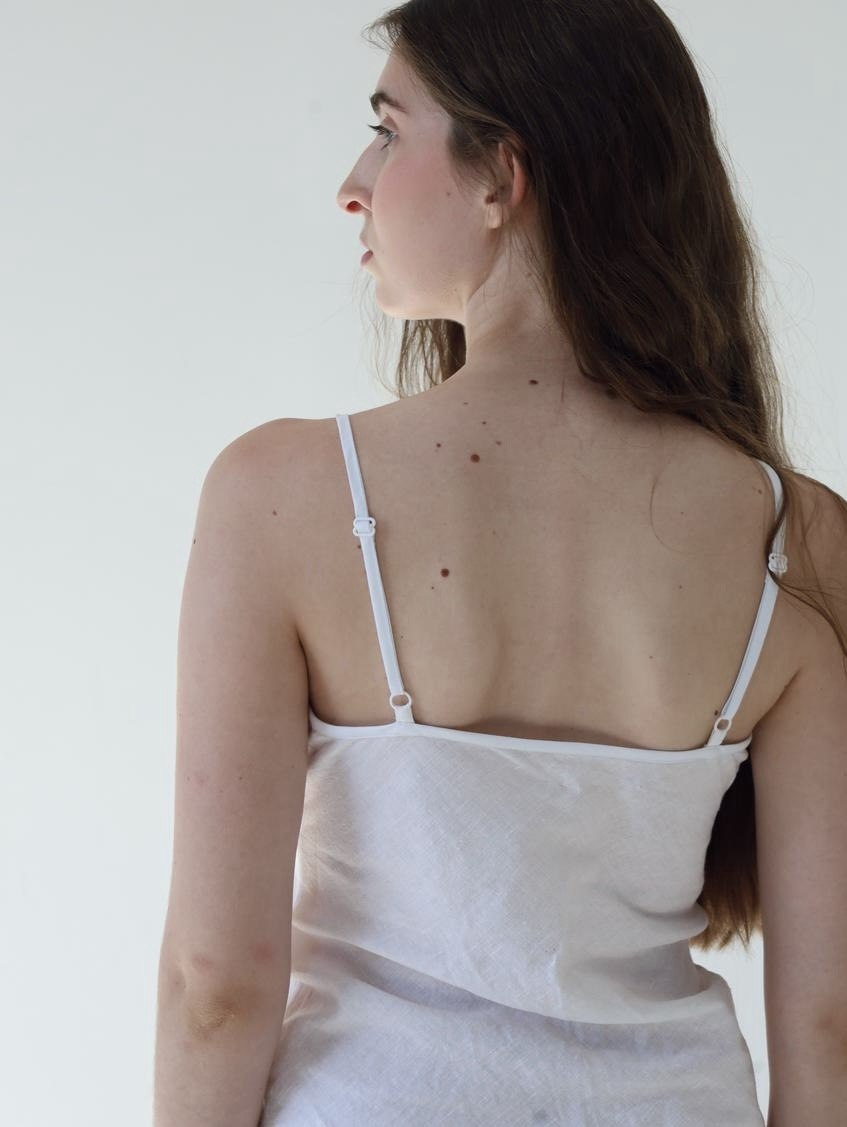 Linen top